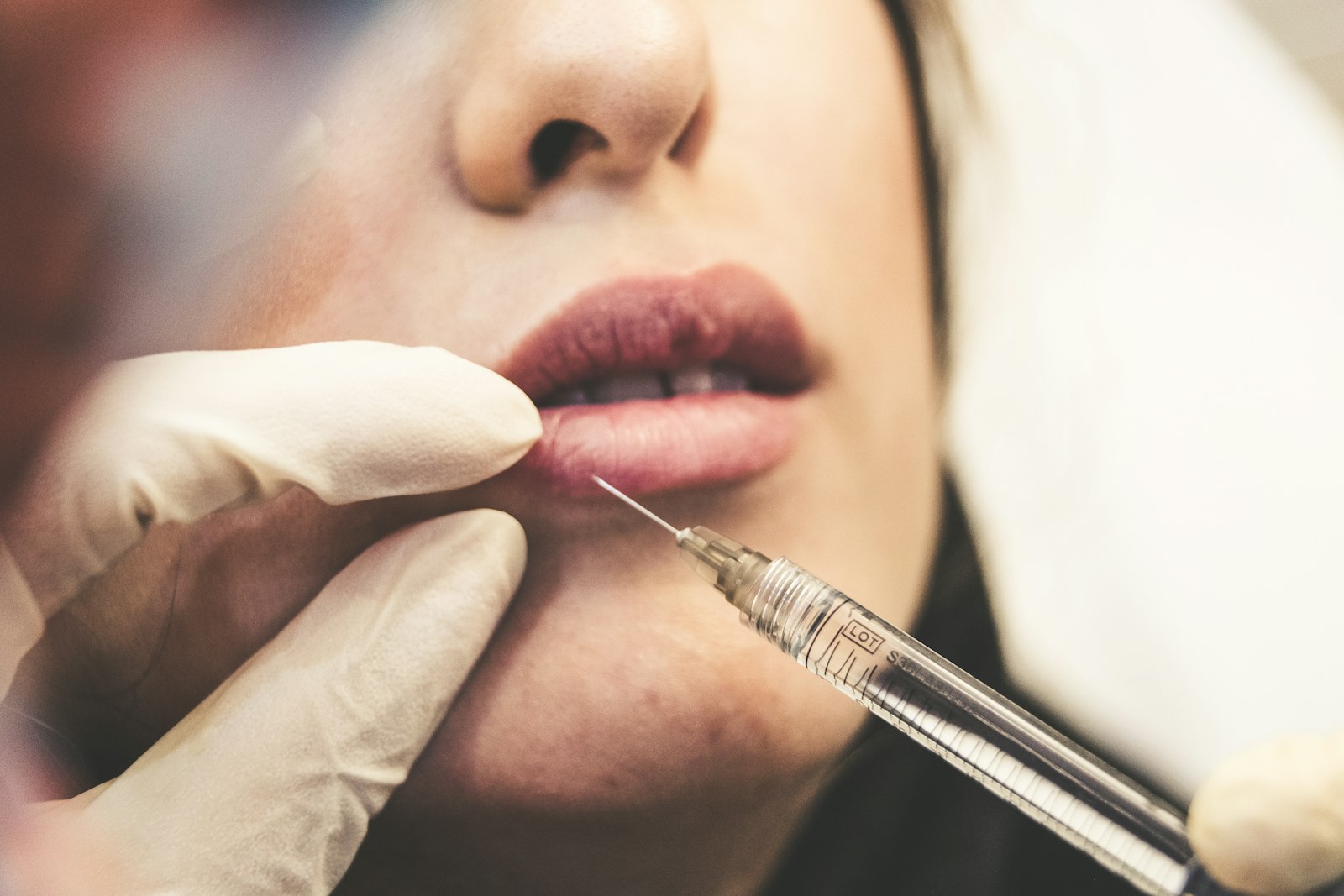 A clinician preparing a precise cosmetic injection near a client's lip