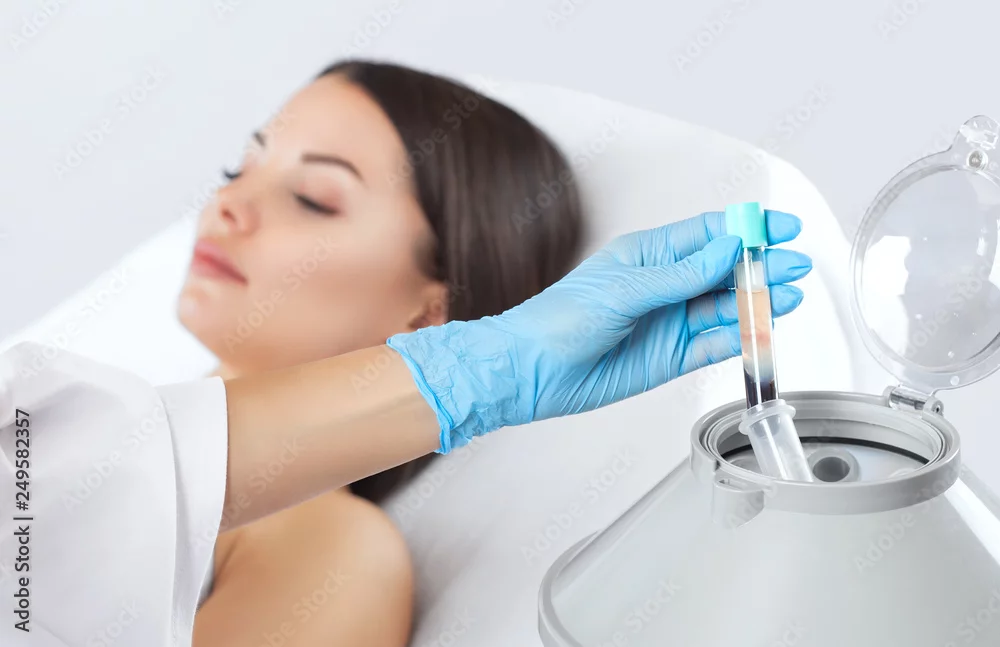 PRP preparation at a centrifuge